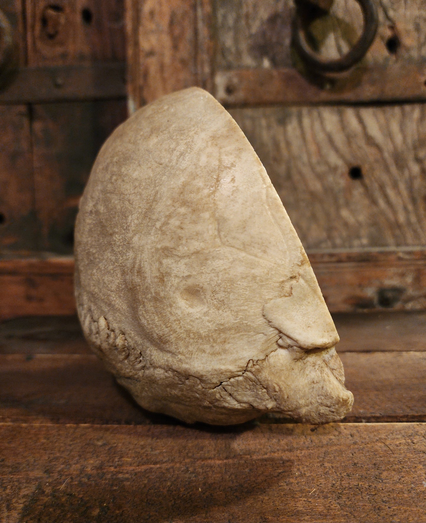 Medical Human Skull Cap