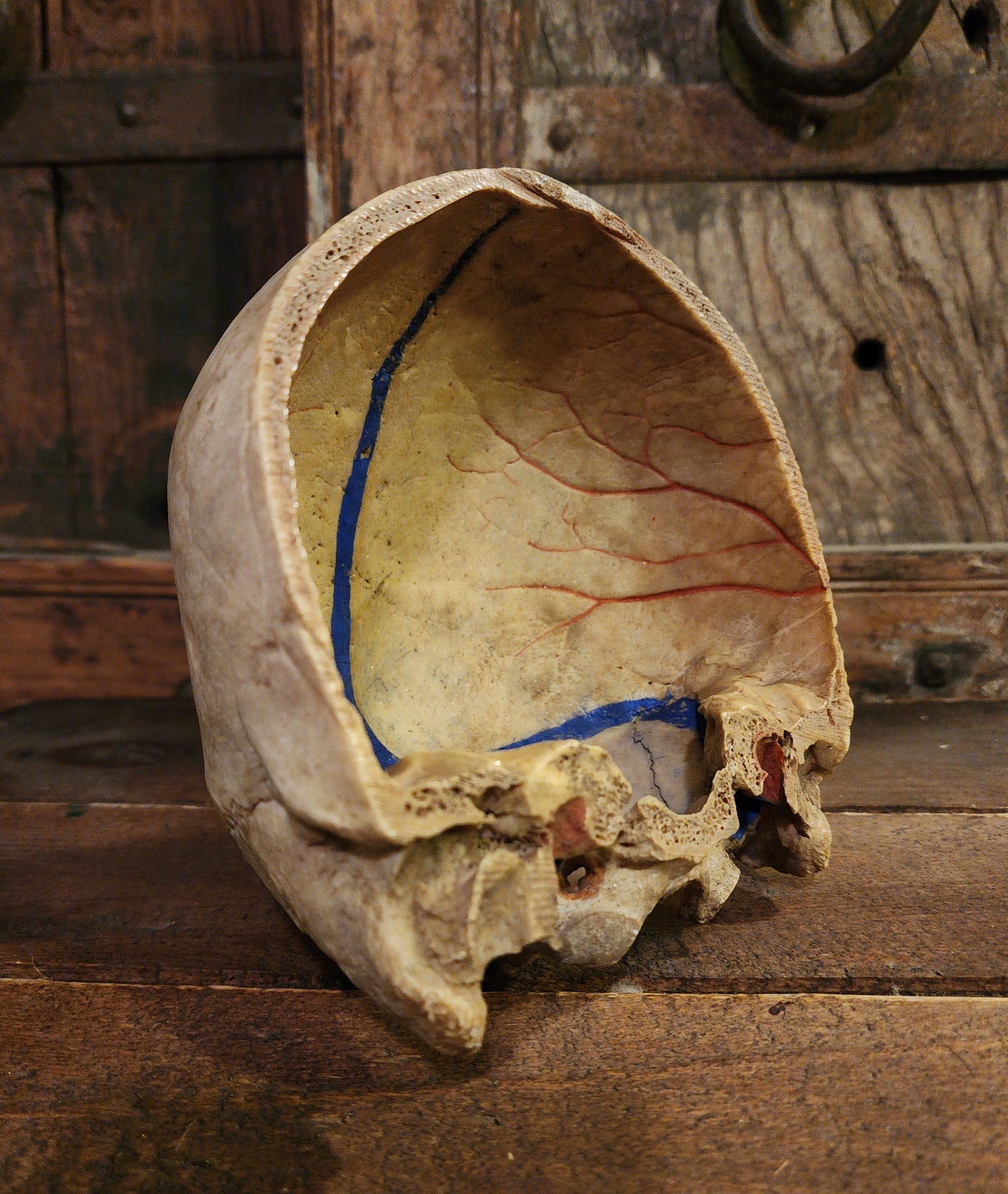 Medical Human Skull Cap