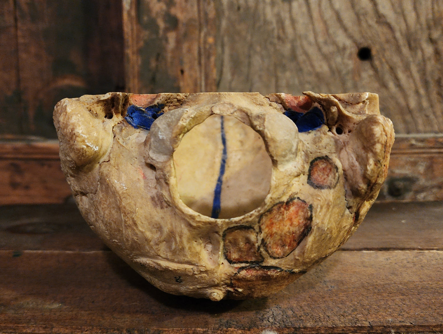 Medical Human Skull Cap