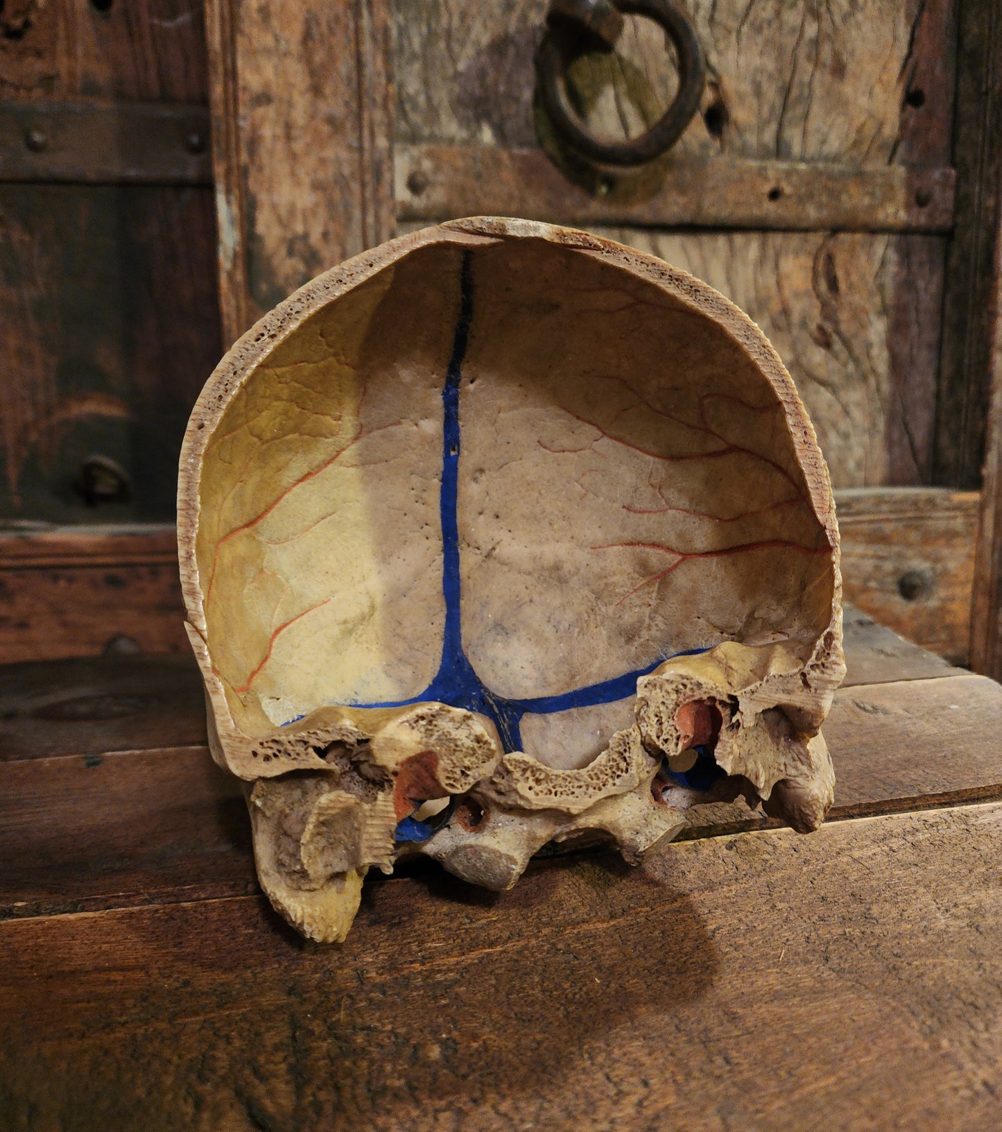 Medical Human Skull Cap