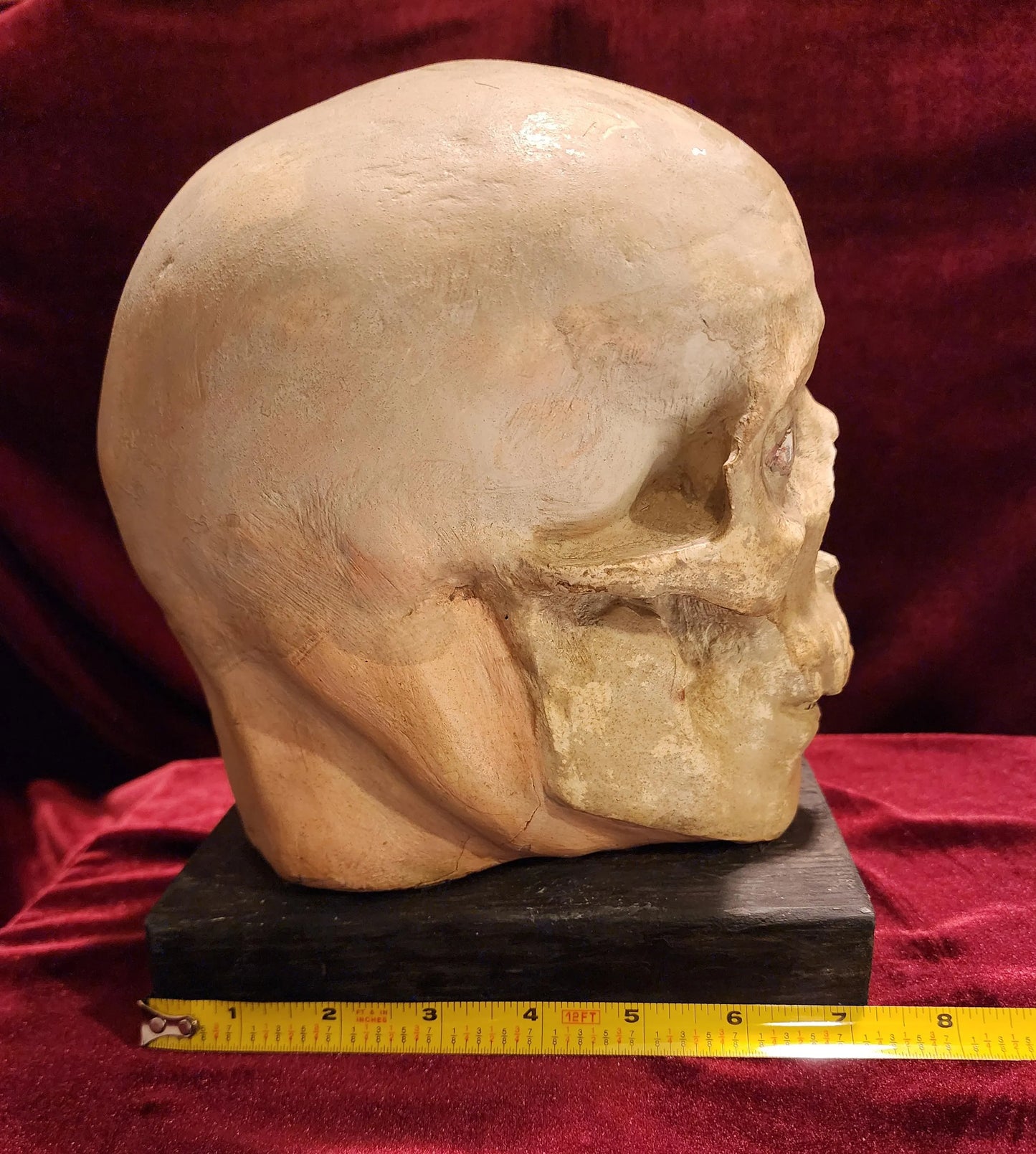 Antique Medical Skull Model