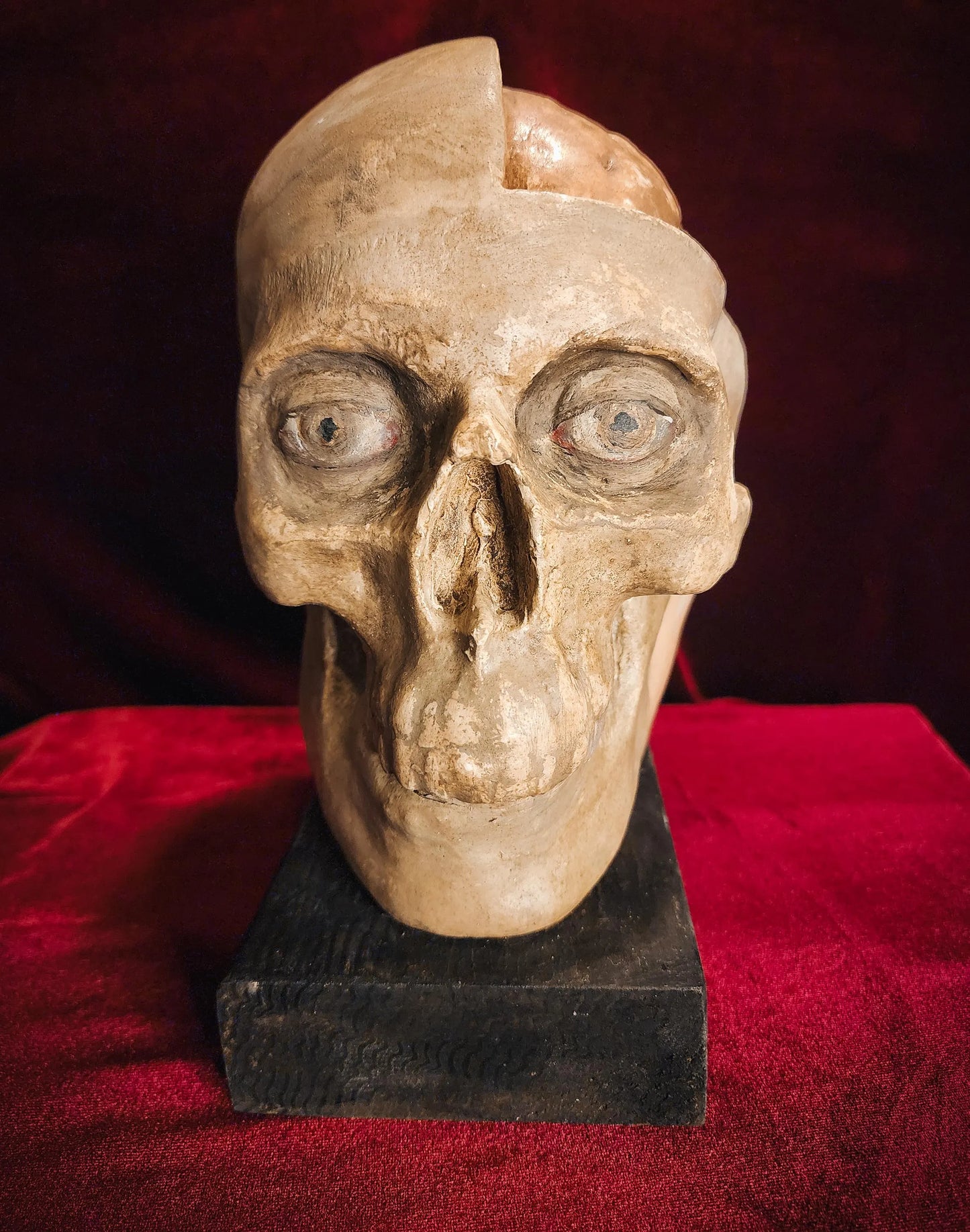 Antique Medical Skull Model