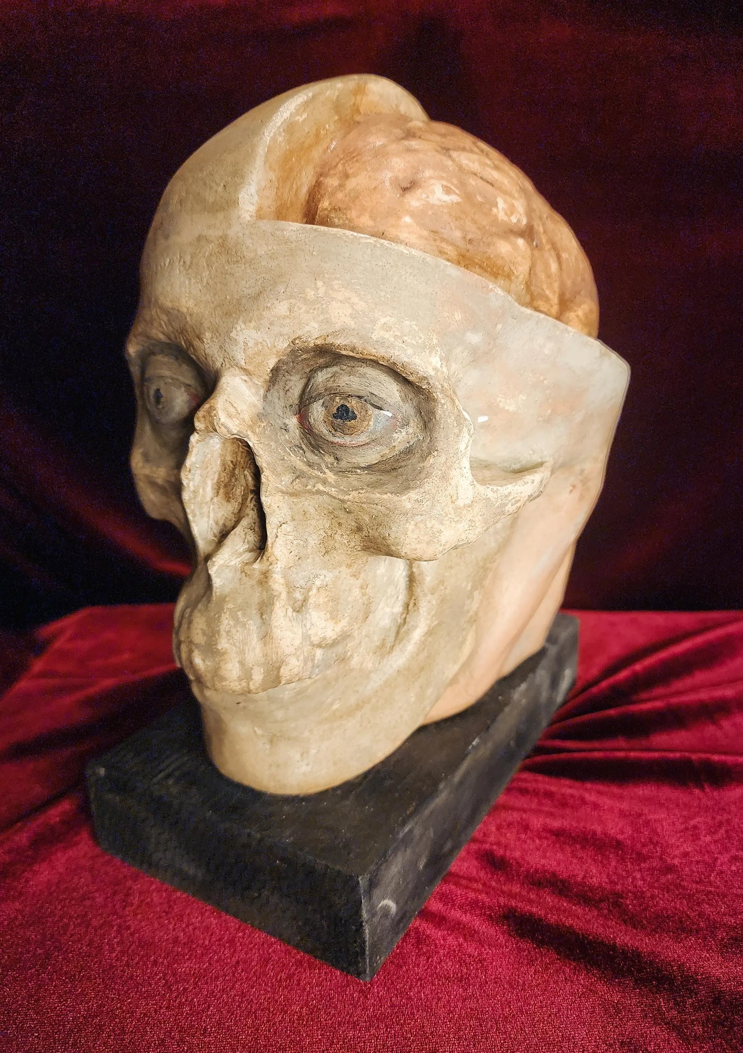 Antique Medical Skull Model
