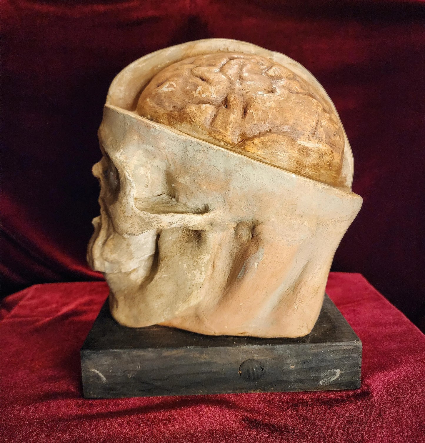 Antique Medical Skull Model
