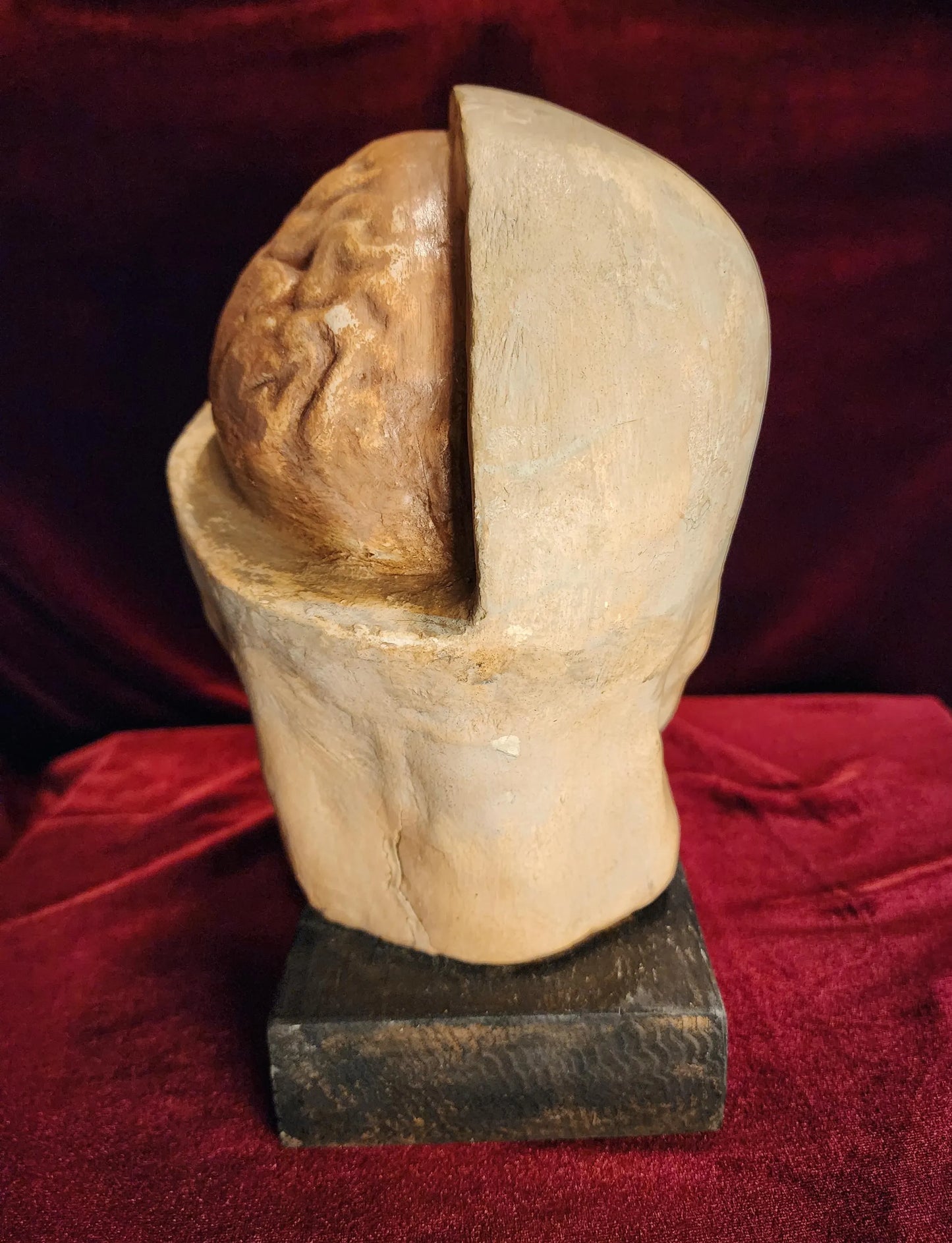 Antique Medical Skull Model
