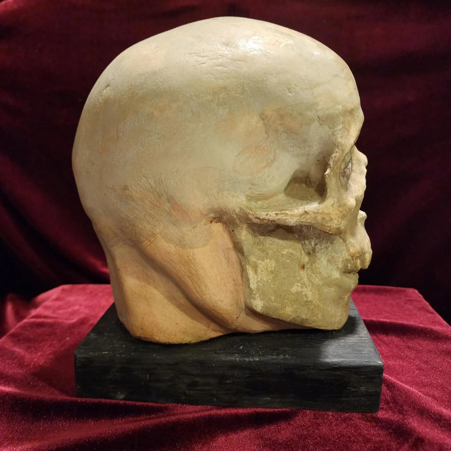 Antique Medical Skull Model