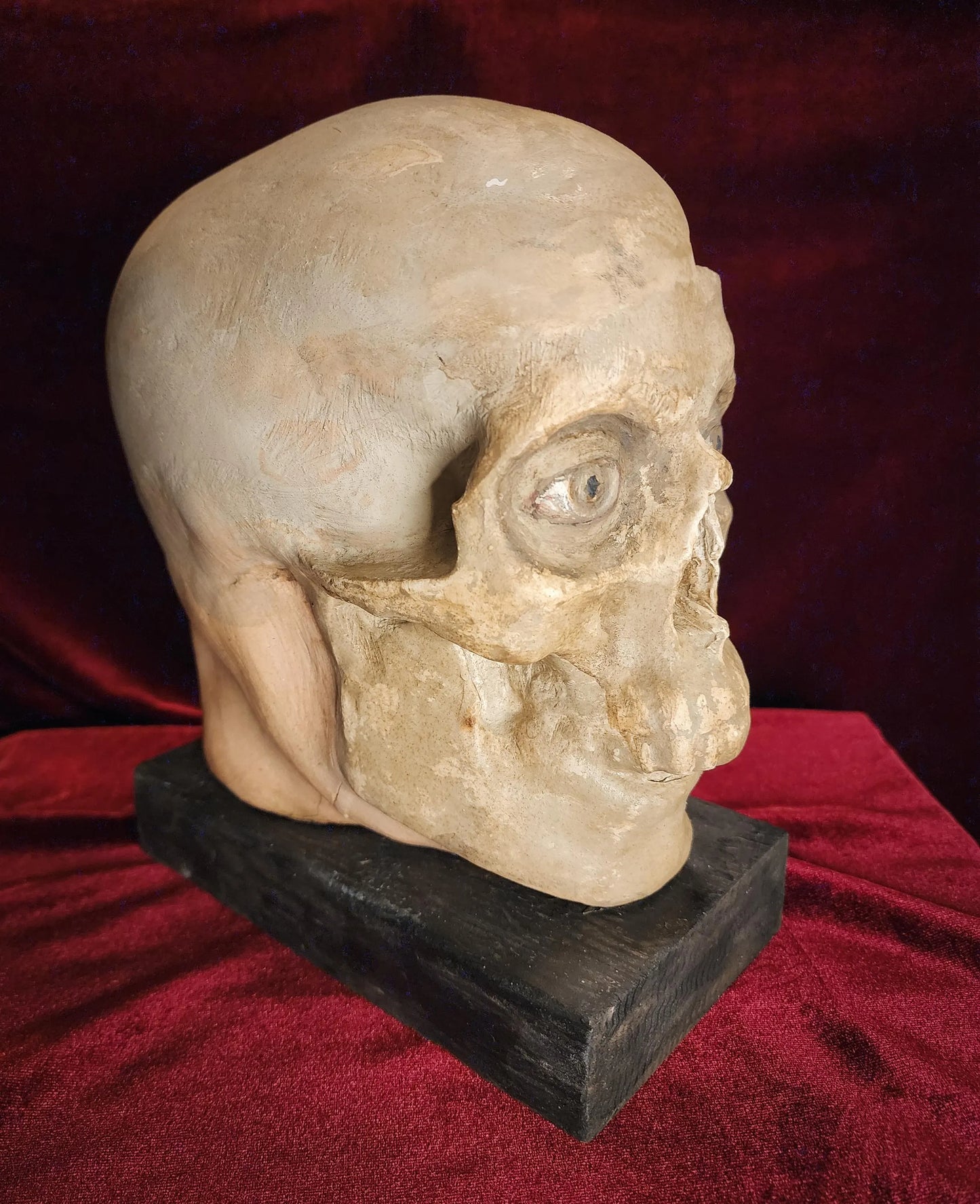 Antique Medical Skull Model