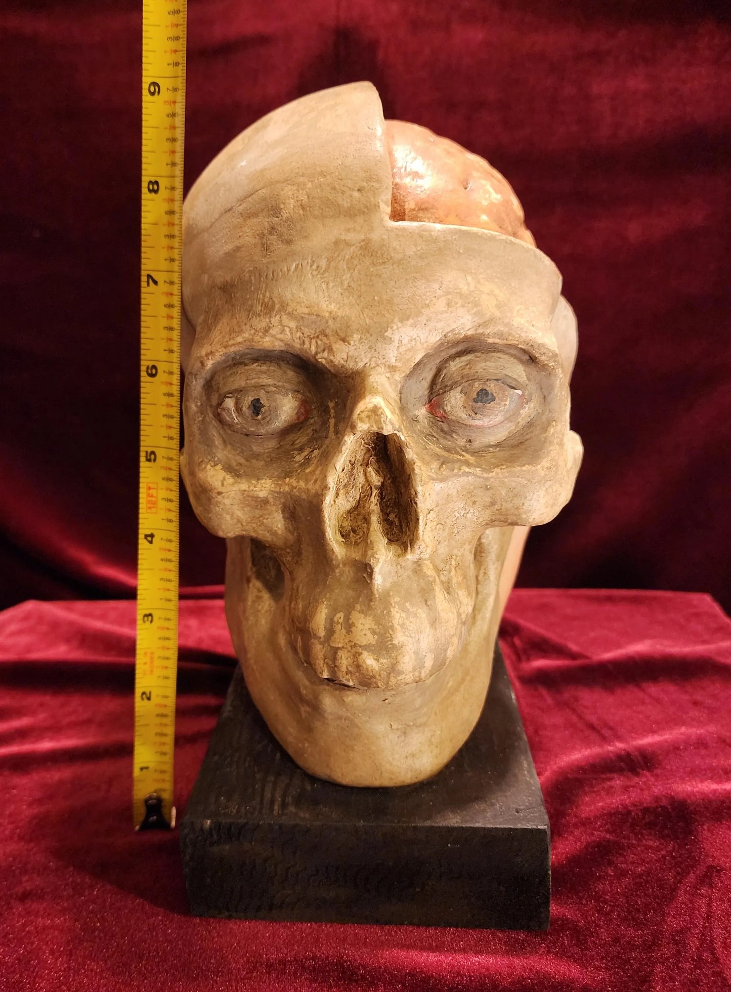 Antique Medical Skull Model
